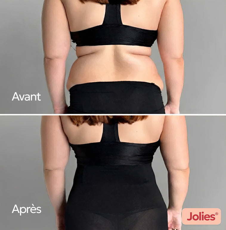 UltraShaper® – Gaine Sculptante