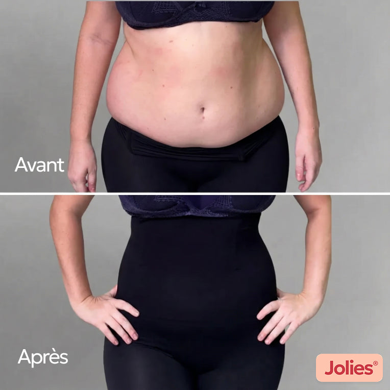 UltraShaper® – Gaine Sculptante